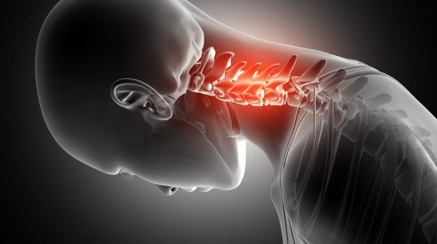 How to treat a Neck pain?